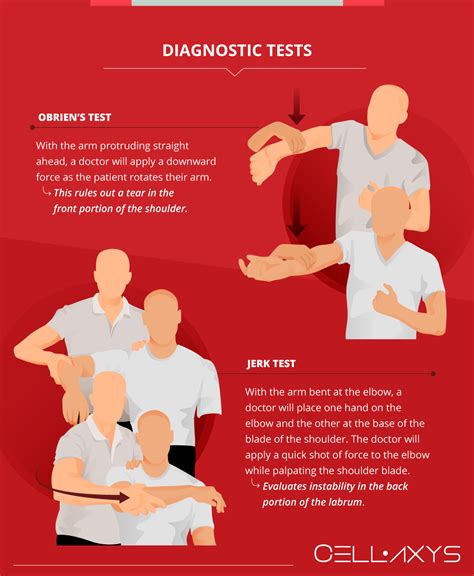 types of labral tear tests shoulder|speed's test vs o'brien's.